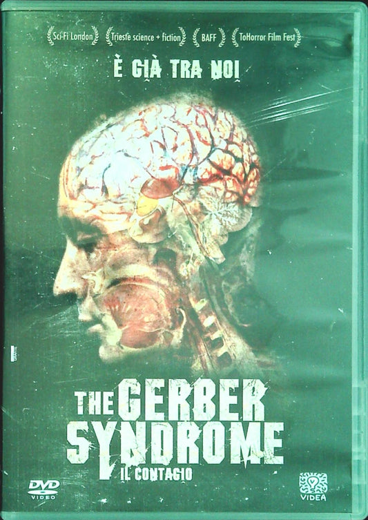 THE CERBER SYNDROME - DVD