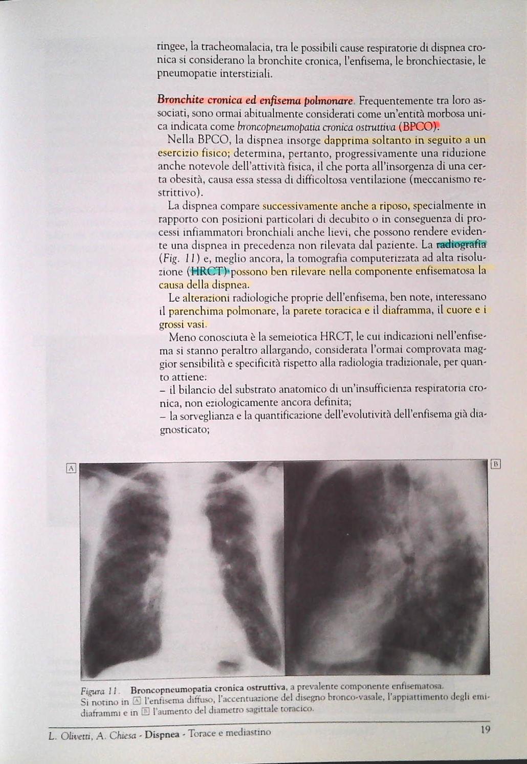 DIAGNOSTICA PER IMMAGINI IN MAEDICINA CLINICA - A. CHIESA-L. OLIVETTI